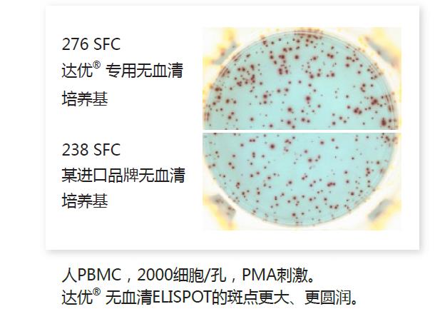 人淋巴細(xì)胞無血清培養(yǎng)基-斑點(diǎn)2.jpg 人淋巴細(xì)胞無血清培養(yǎng)基-斑點(diǎn)2.jpg